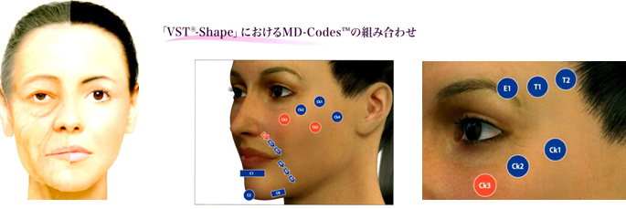 MD-Codes  / VST-Shape  / VST-Eye　　MYシェイプ