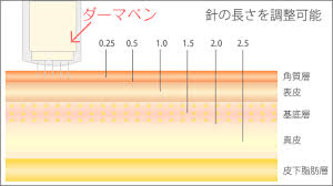 ダーマペン