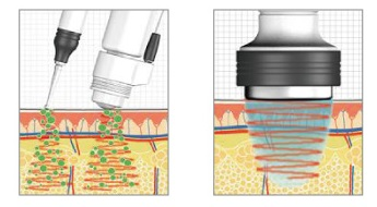 エレクトロポーション（電気穿孔法）とは