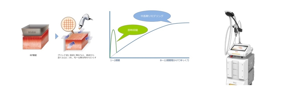 あっくジェン