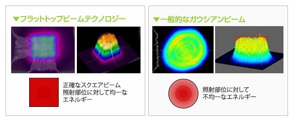 myQ:デュアルレーザー・レーザートーニング