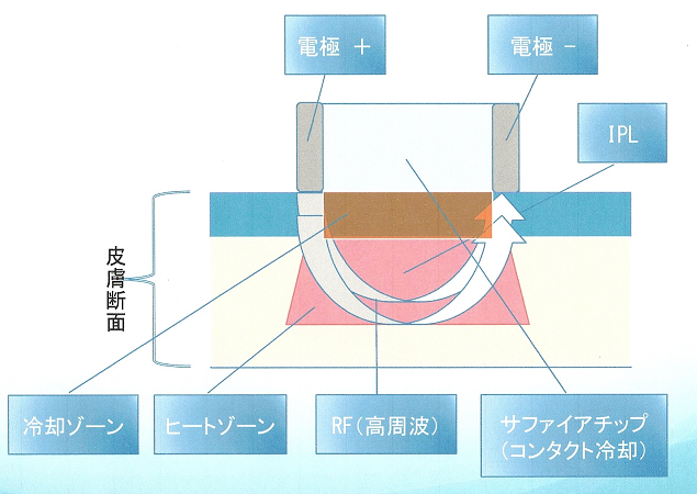 フォトソール②