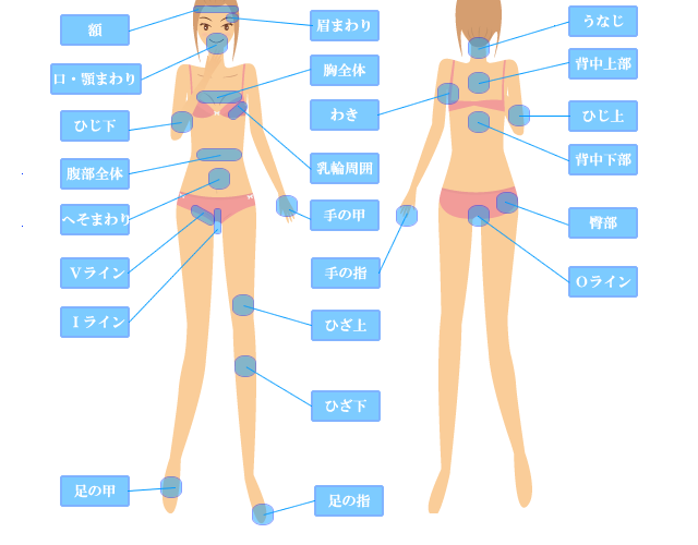 医療レーザー脱毛